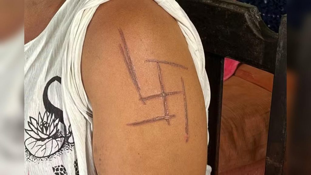 Mulher é torturada e tem suástica marcada na pele em MS; patrões são presos