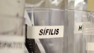 Centro de SP tem testagem grátis de HIV, hepatite, síflis e gonorreia