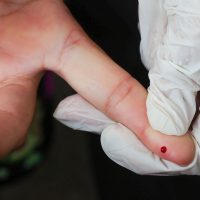 Imagem referente a SUS passa a oferecer teste rápido de dengue