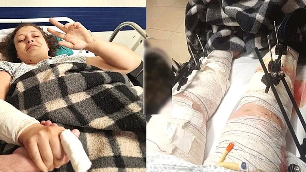 Jovem mãe ferida em acidente com viatura da PM precisa de ajuda para tratamento