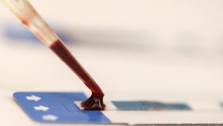 Estudo inédito da Fiocruz pode ampliar prevenção de HIV entre jovens