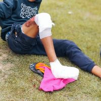 Imagem referente a Motociclista tem várias lesões após sofrer queda de moto