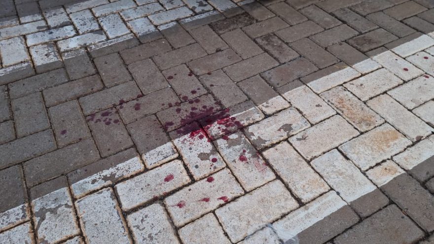 Adolescente fica ferido em acidente na via marginal da PRc-467