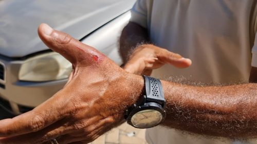 “Eu só vi quando o carro estava apontando”, relata motorista envolvido em acidente no Floresta “Eu só vi quando o carro estava apontando”, relata motorista envolvido em acidente no Floresta