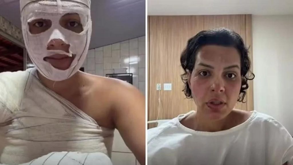 Nutricionista tem 33% do corpo queimado após saco de lixo explodir