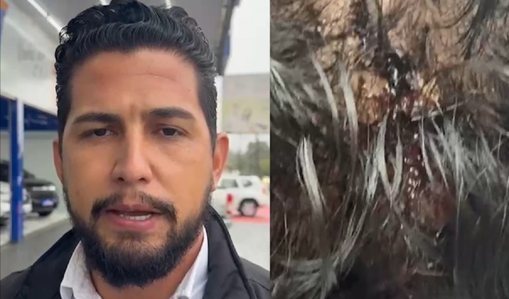 “Hoje eu poderia estar em óbito”, diz gerente de loja atingido na cabeça por barra de ferro