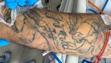 Imagem referente a HUOP procura familiares de homem atropelado e internado desde sábado em Cascavel