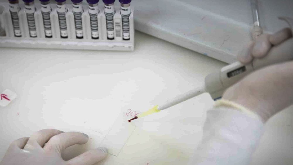 Paciente em SP com suspeita de ebola testa positivo para meningite Imagem referente a Paciente em SP com suspeita de ebola testa positivo para meningite
