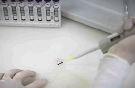 Paciente em SP com suspeita de ebola testa positivo para meningite