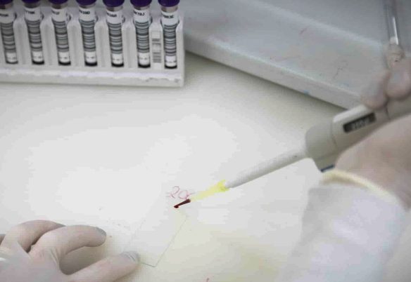Exames descartam ebola em imigrante da República Democrática do Congo
