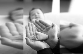 Conhecimento e tratamento mudam a vida de pacientes com pé torto congênito