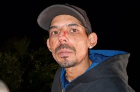 "Pensei que ia morrer", relata motorista após pneu estourar e carro atingir mureta na PR-180