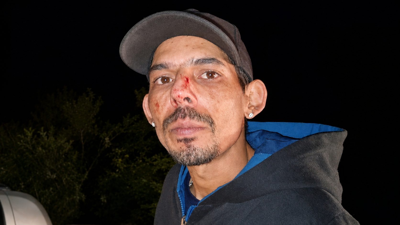 “Pensei que ia morrer”, relata motorista após pneu estourar e carro atingir mureta na PR-180
