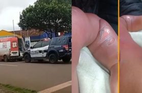 Bebê de 9 meses sofre queimaduras graves durante banho em CMEI no PR e é levado às pressas para cirurgia Bebê de 9 meses sofre queimaduras graves durante banho em CMEI no PR e é levado às pressas para cirurgia