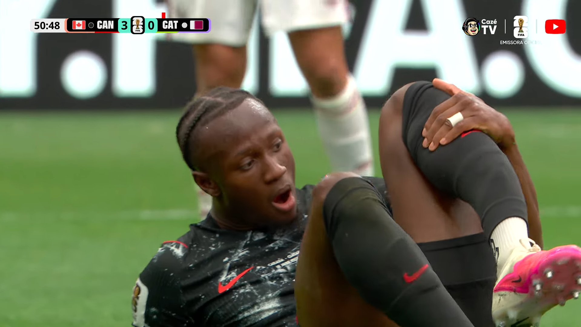 Imagem relativa a Jogador do Canadá sofre grave fratura na perna durante partida da Copa do Mundo