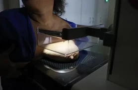 ANS defende que plano cubra mamografia digital sem restrição de idade