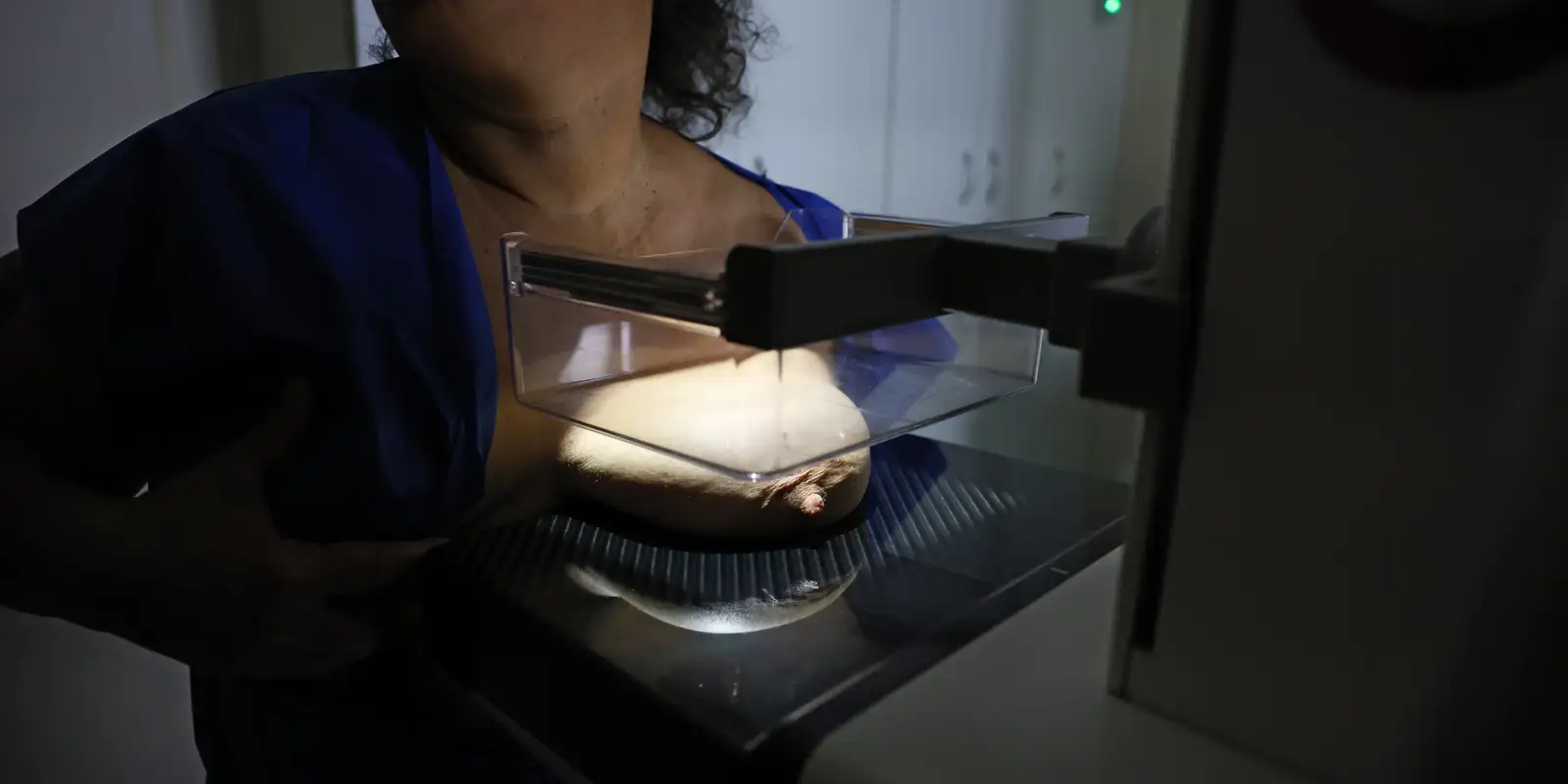 Imagem referente a ANS defende que plano cubra mamografia digital sem restrição de idade
