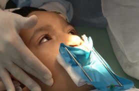 Fissura labiopalatina demanda tratamento precoce e multidisciplinar Fissura labiopalatina demanda tratamento precoce e multidisciplinar