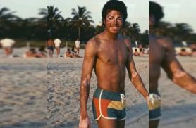 As manchas não contagiam. O preconceito, sim: por que o Dia Mundial do Vitiligo ainda é tão importante