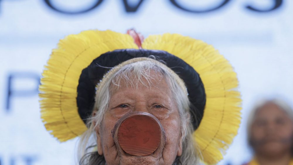 Cacique Raoni tem hemorragia digestiva, mas quadro é estável Imagem referente a Cacique Raoni tem hemorragia digestiva, mas quadro é estável