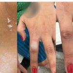 Imagem relativa a Homem ateia fogo na esposa após discussão por unhas vermelhas e é preso