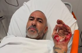 Henrique Fogaça dá detalhes de acidente de moto e revela que aliança foi 'roubada' no hospital
