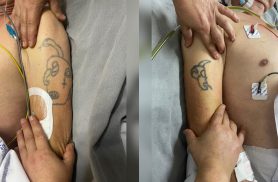 HU procura por familiares de paciente que deu entrada na unidade após atropelamento em Cascavel HU procura por familiares de paciente que deu entrada na unidade após atropelamento em Cascavel