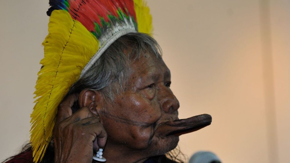 Cacique Raoni apresenta boa evolução clínica e vai para enfermaria Imagem referente a Cacique Raoni apresenta boa evolução clínica e vai para enfermaria