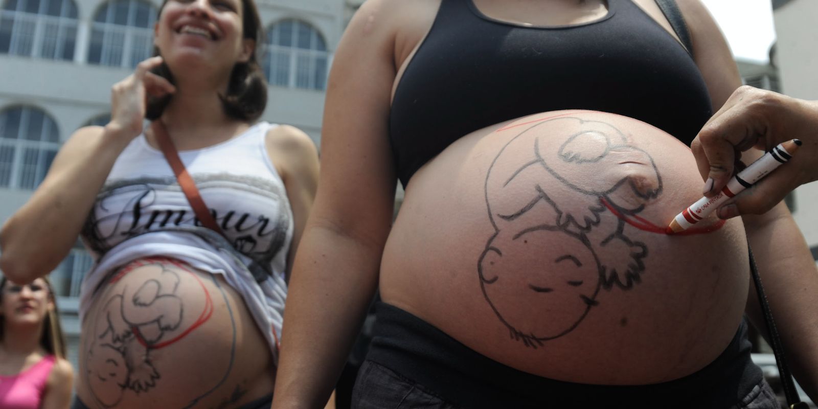 Fatores sociais e estruturais empurram mulheres para cesarianas Imagem referente a Fatores sociais e estruturais empurram mulheres para cesarianas