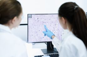 Anvisa aprova novo medicamento para linfoma não Hodgkin