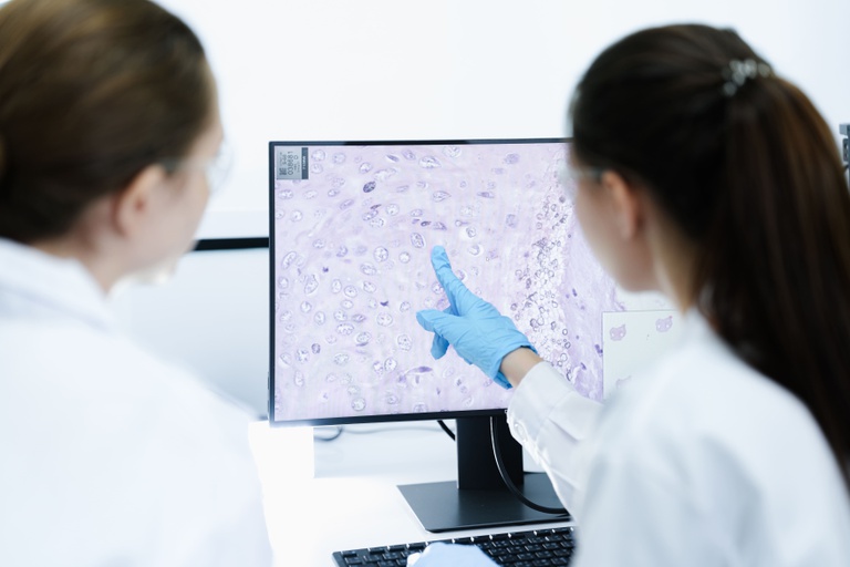 Anvisa aprova novo medicamento para linfoma não Hodgkin Imagem referente a Anvisa aprova novo medicamento para linfoma não Hodgkin