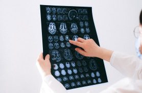 Muito além da inteligência: cérebro controla praticamente tudo no corpo humano
