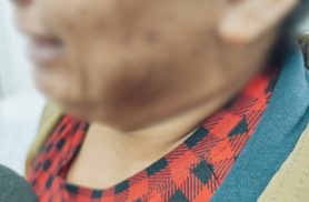 "Ela disse que ele passava o pintinho no bumbum", relata mãe após denúncia de estupro contra padrasto