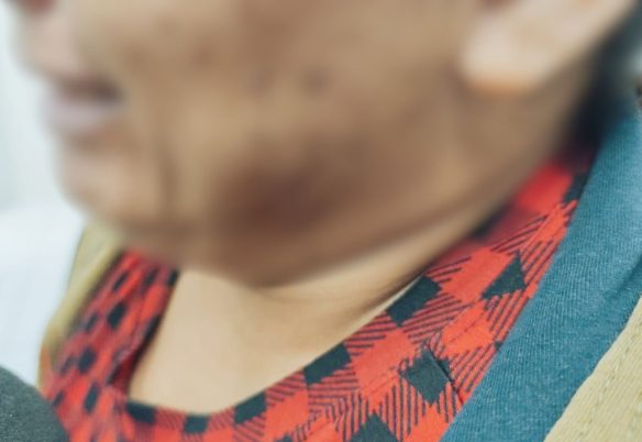 "Ela disse que ele passava o pintinho no bumbum", relata mãe após denúncia estupro contra padrasto