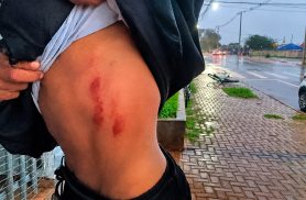 Ciclista fica ferido após acidente com carro no bairro Tarumã, em Cascavel