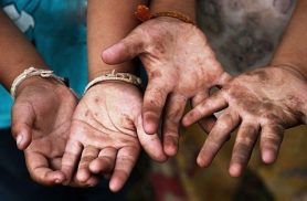 Unicef cobra compromisso com a infância do próximo governador do Rio