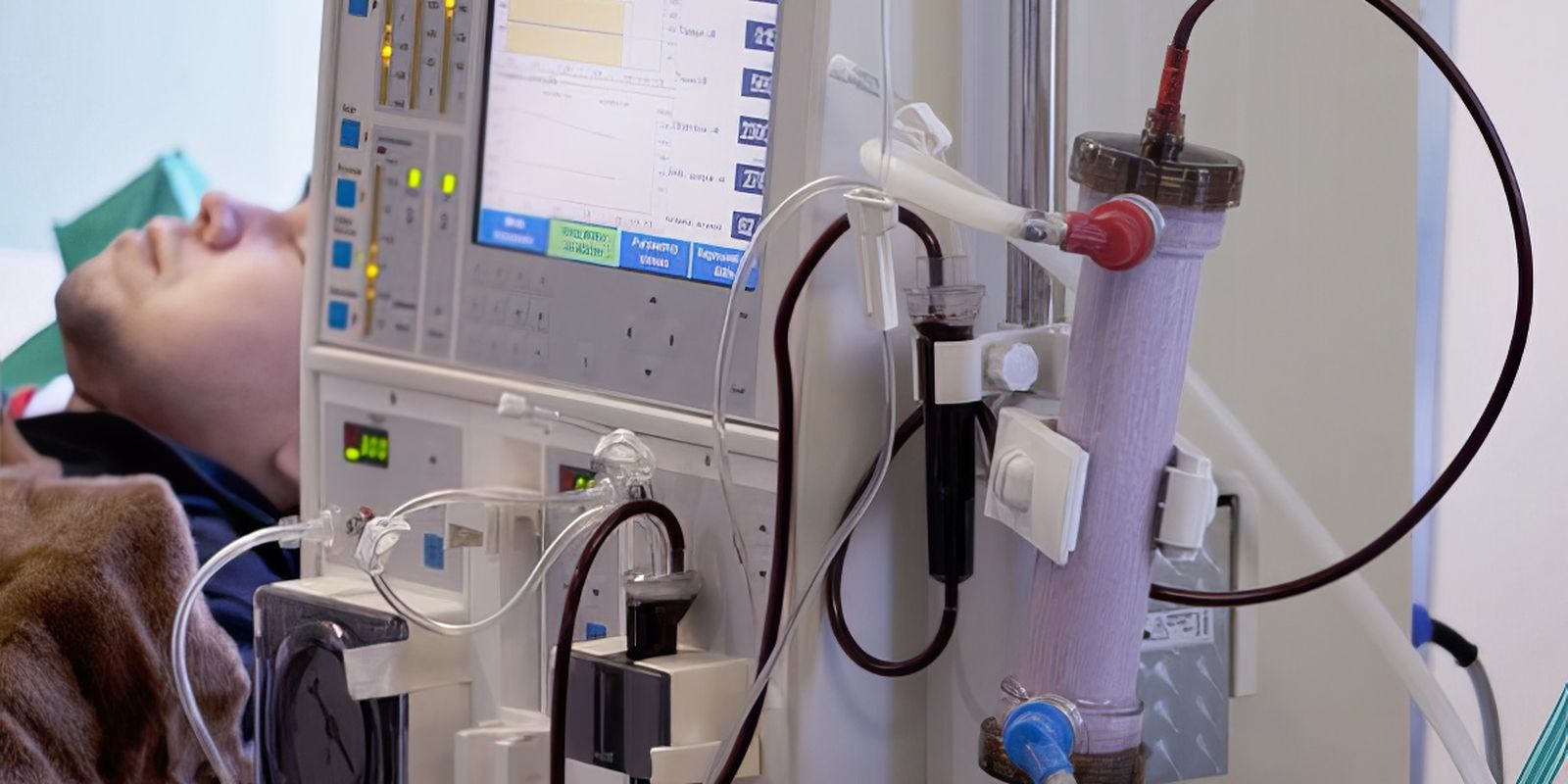 Imagem referente a Estudo alerta para subdiagnóstico da doença renal crônica no Brasil