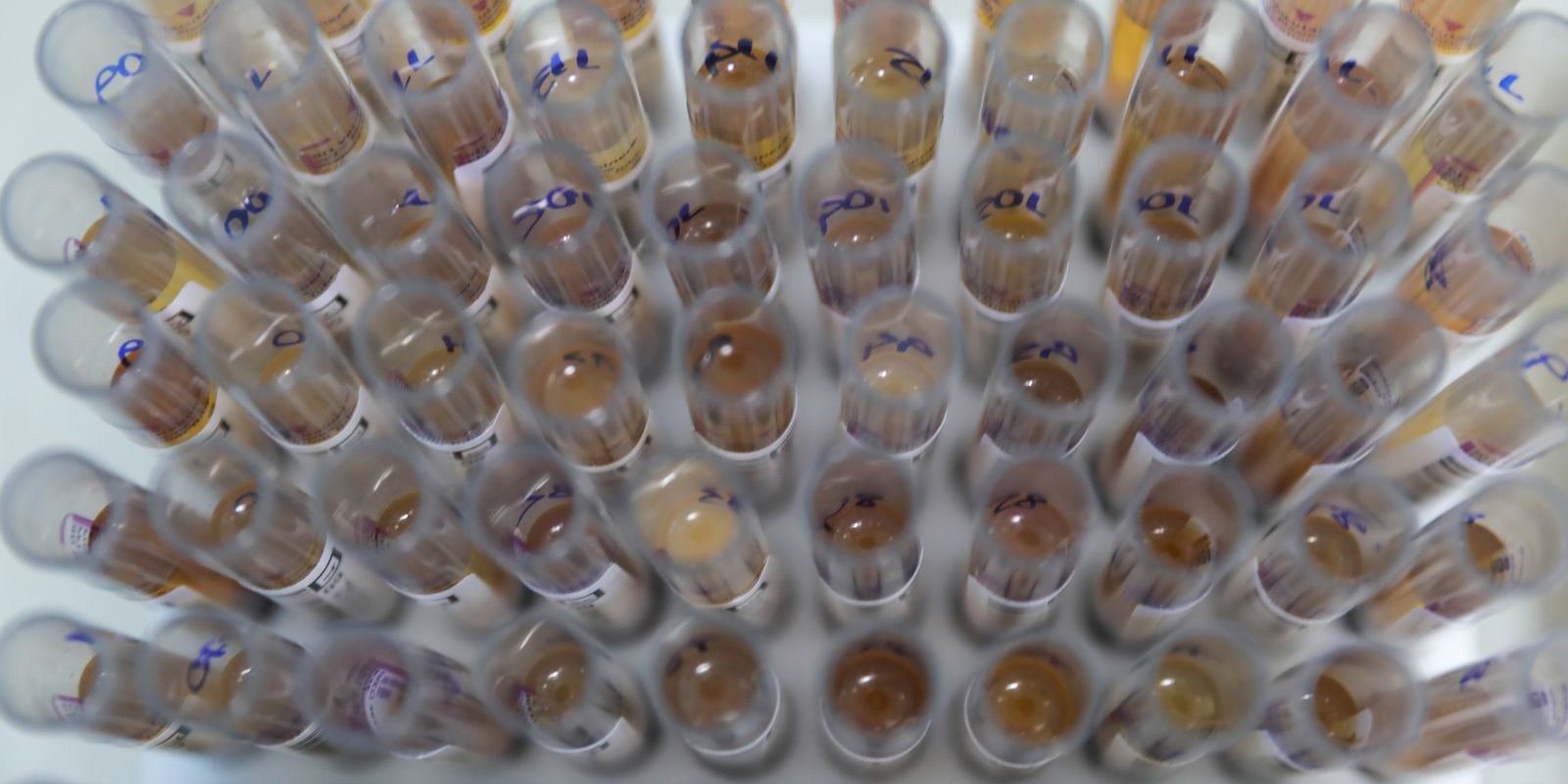 Imagem referente a Uso de medicamento oferecido no SUS reduz casos de malária no Brasil