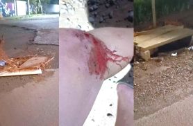Motociclista sofre queda e reclama de pedras soltas em trecho de obras no Brasmadeira, em Cascavel Motociclista sofre queda e reclama de pedras soltas em trecho de obras no Brasmadeira, em Cascavel
