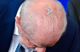 O que Lula tem na cabeça?