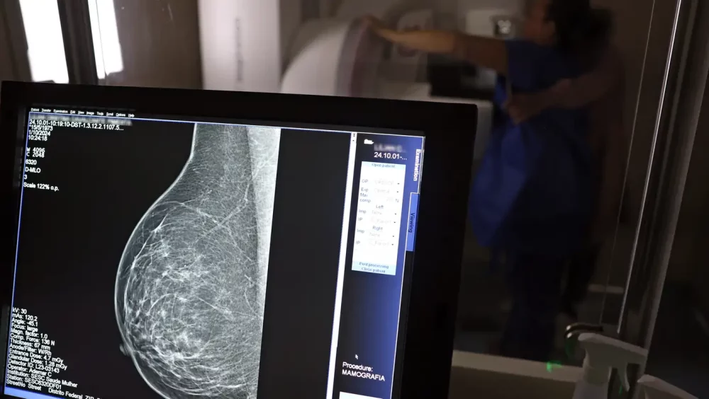 Plano de saúde terá que cobrir mamografia digital para todas as idades Imagem referente a Plano de saúde terá que cobrir mamografia digital para todas as idades