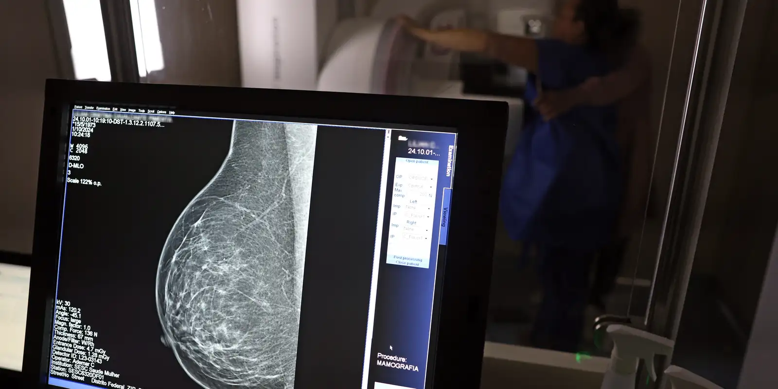 Plano de saúde terá que cobrir mamografia digital para todas as idades Imagem referente a Plano de saúde terá que cobrir mamografia digital para todas as idades
