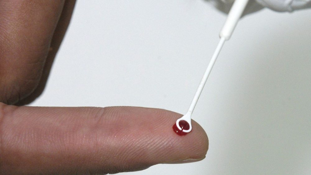 Fiji declara emergência nacional por HIV com 1 caso a cada 60 pessoas Imagem referente a Fiji declara emergência nacional por HIV com 1 caso a cada 60 pessoas