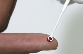 Fiji declara emergência nacional por HIV com 1 caso a cada 60 pessoas