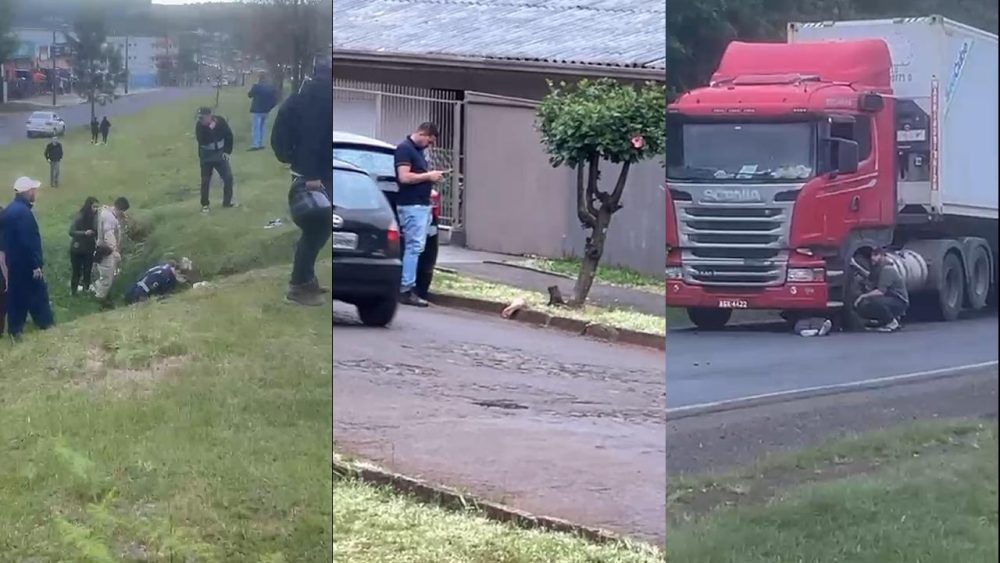 Imagem referente a Gestante tem perna amputada após ser atropelada por moto