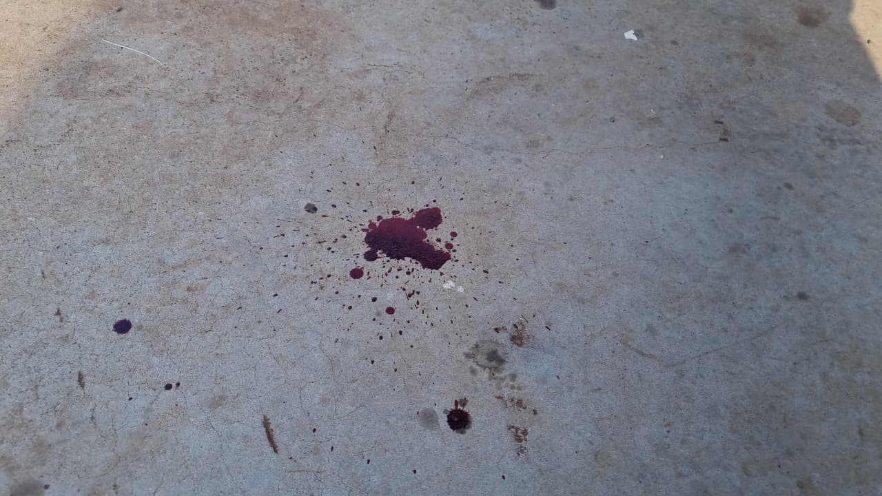 Idosa sofre queda e fica ferida ao descer do ônibus no Bairro Neva