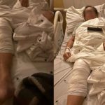 Imagem relativa a 'Não poderia ter acontecido', diz idosa que teve prótese implantada no joelho errado