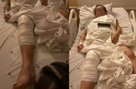 'Não poderia ter acontecido', diz idosa que teve prótese implantada no joelho errado