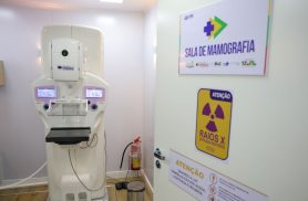 Homens costumam descobrir câncer de mama em estágio mais avançado Homens costumam descobrir câncer de mama em estágio mais avançado