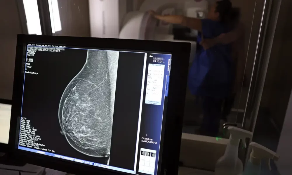 Imagem referente a Médicos lançam guia para evitar recusa de mamografia digital